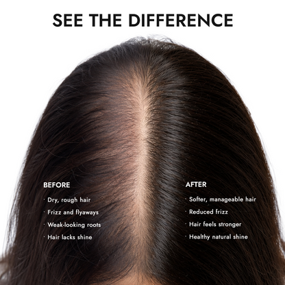 Hair Root +